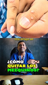 ¿Tienes mezquinos? 😲 Te contamos qué son y cómo eliminarlos de una vez | DR. RAWDY