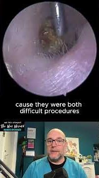 Neurodivergent ear wax patients, Full video in link below.