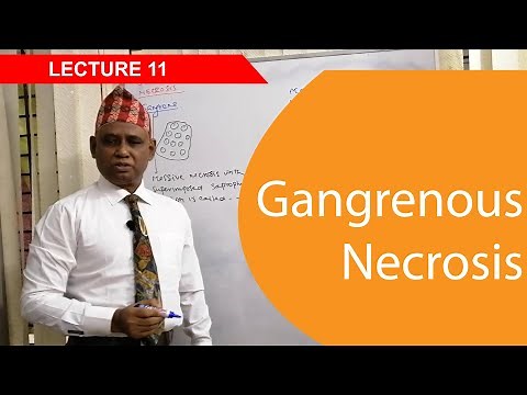 General Pathology: Lecture 11 | Gangrenous Necrosis