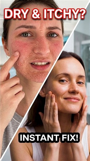 Why you have dry, itchy skin (And how to fix it) 💧 #skincare #skincaretips #dryskin