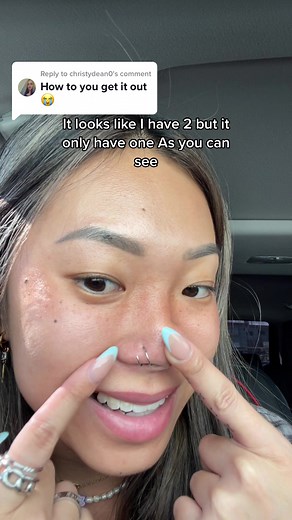 How to Safely Remove Different Types of Nose Rings