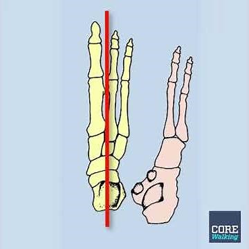 1 Minute Anatomy: Arches of the Feet