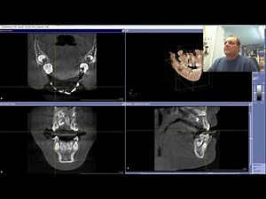 Galileos Implant Viewer von Sirona - Installationsanleitung - Bedienungsanleitung