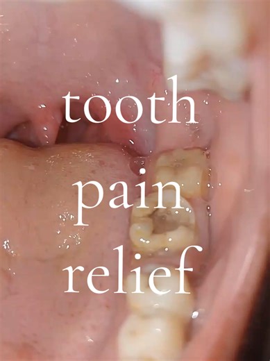 Effective Tooth Pain Relief Remedies