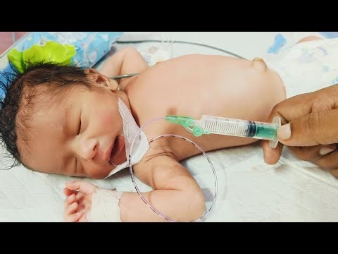 Newborn Baby Diagnosed with Sepsis | NICU Admission,Initial Assessment & High Fever Care by RG Nurse