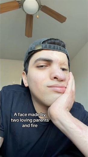 A Face Forged By Loving Parents & Fire