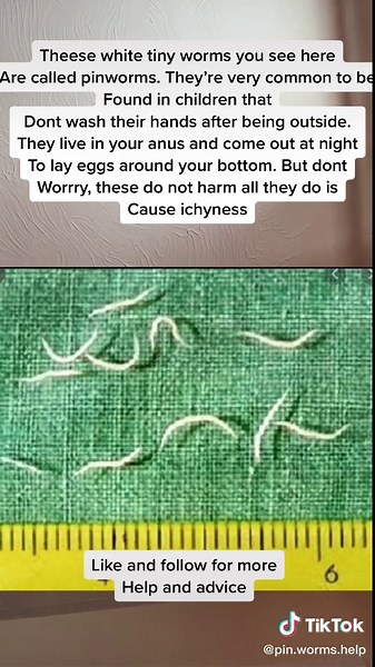 Pinworms help and facts! on TikTok