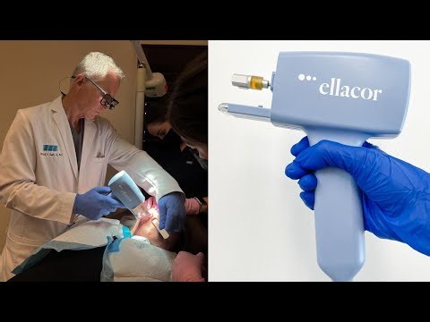 Ellacor : Micro-Coring Treatment