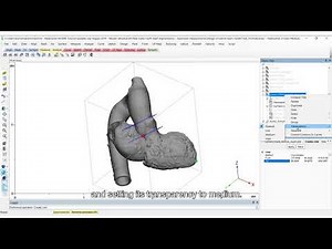 How to perform advanced measurements on the heart in MIS?