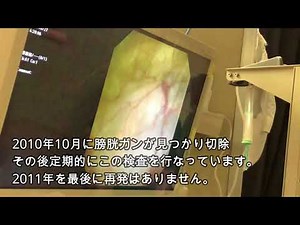 軟性膀胱鏡検査2018/6/27