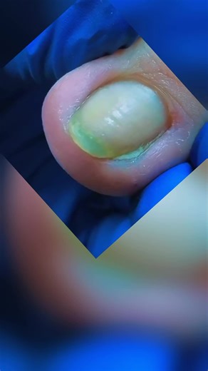 Cute and Satisfying Pedicure Nail Designs