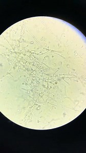 129K views · 1.8K reactions | Urine slide ❤️ | Lab life | Facebook