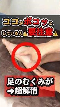 Leg swelling relief care
