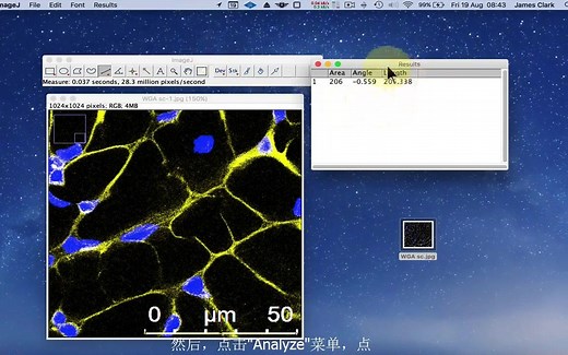 [ImageJ][中字]细胞截面积与细胞计数的测量