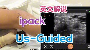 【麻醉技术】超声引导下ipack阻滞 腘动脉与膝关节后囊间隙 英文解说 慢速0.8 双语字幕 翻译人工校对