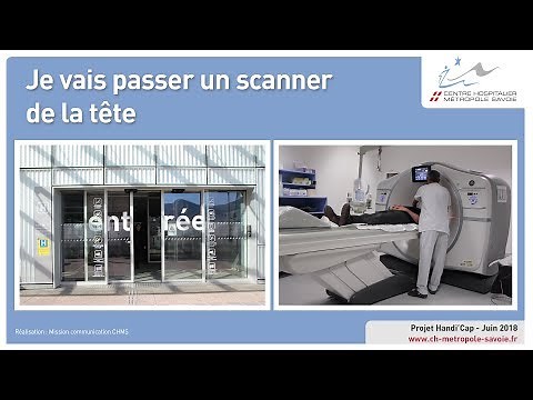 Je vais passer un scanner de la tête