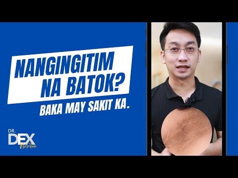 Nangingitim na batok? Baka may sakit ka.