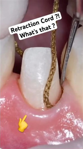 Is that a Dental Floss?