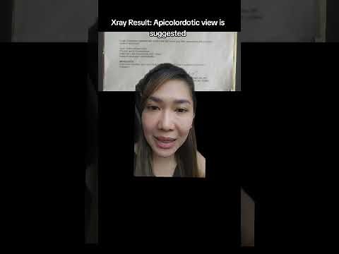 Apicolordotic View on xray?