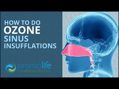 How to do an Ozone Sinus Insufflation