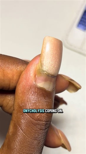 Natural Nail Growth & Recovery Journey