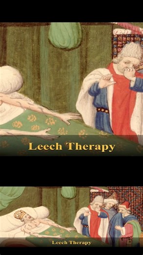 Leach Therapy | Ancient Medical Procedure that are Still Used #shorts #science #medicalhistory