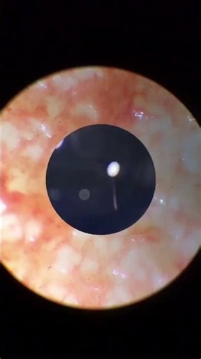 #microscope #magnification