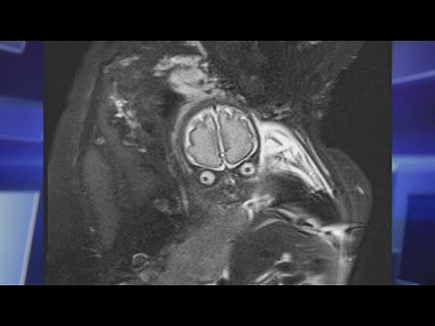 The Baby Ultrasound That Looked like an Alien?