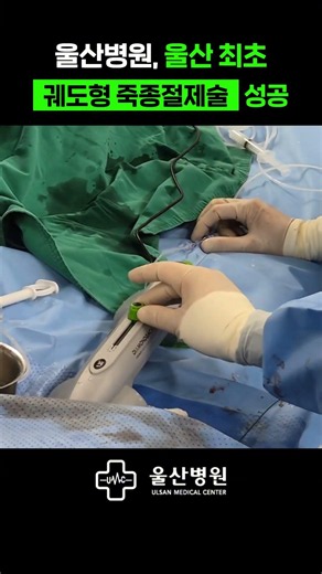 🏥 울산병원, 울산 최초 궤도형 죽종절제술 성공#shorts