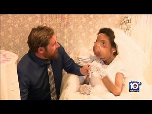 Woman had 16-pound tumor removed from her face in Miami — now she’s found love