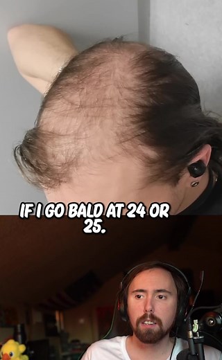 LMAO #bald #baldhead #balding #asmongold #asmongoldclip #asmongoldclips #asmongoldreacts