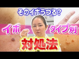 そのイボうつる？イボのタイプ別対処法！