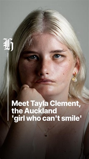 Auckland-based influencer Clement was born with Moebius syndrome, a rare neurological disorder affecting her sixth and seventh cranial nerves. An estimated two to 20 per 1 million people are born with Moebius syndrome worldwide. | nzherald.co.nz
