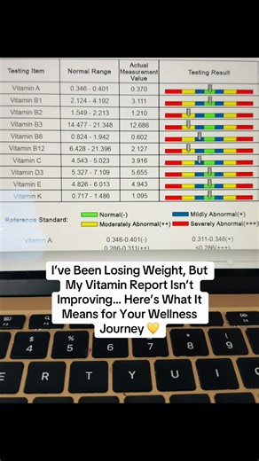 Before you start any diet or weight-loss plan, knowing your body’s actual needs is 🔑. My latest vitamin analysis revealed areas that need attention—yes, even while shedding kilos! Some nutrients are low (yellow ⚠️), others need a boost (blue 💧), and this is exactly why testing first is so important. I’m now focusing on targeted nutrition, balanced meals, and supplements from my Forever Living wellness routine to fill the gaps and support my body the right way. 🌿💪 Your body is not a guessing 