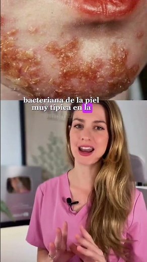 Watch out for this typical SUMMER INFECTION