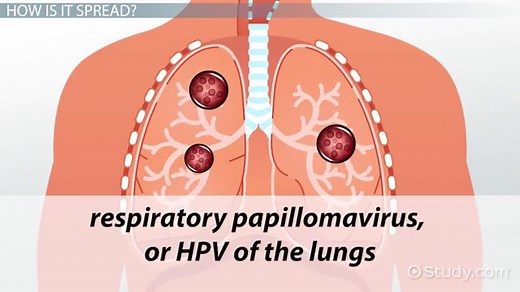 Human Papillomavirus | HPV Structure, Discovery & Growth