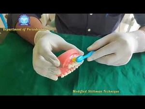 Modified Stillman Toothbrushing Technique
