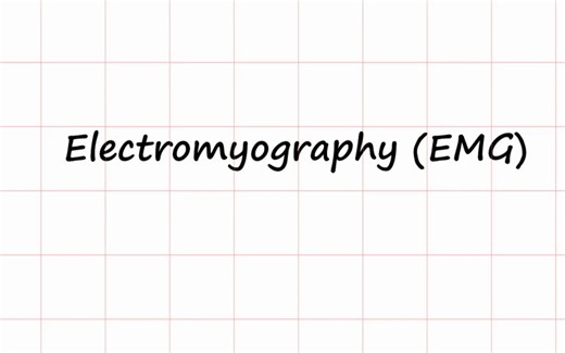 【搬运】肌电信号介绍 EMG II Electromyography II Muscle electrical activity