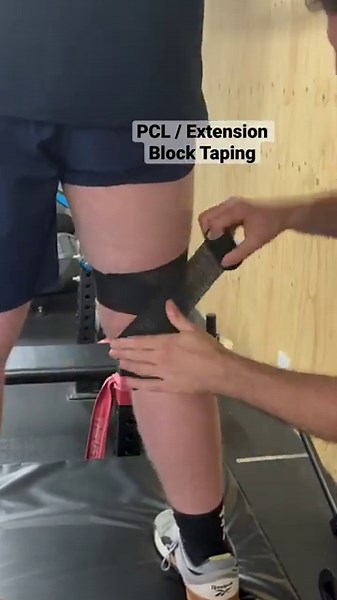 PCL/ Extension Block Taping