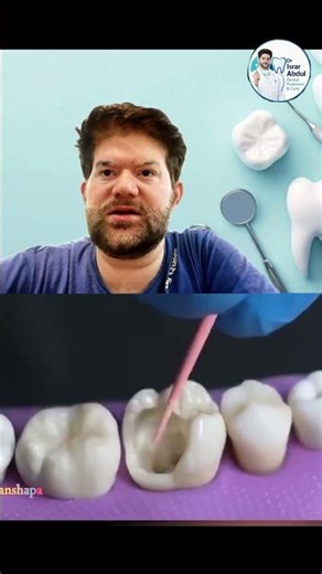 Root canal infection removal process #dentist #teeth #shorts