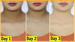 How to Get Rid of Dark Neck Fast & Easy | Natural Remedy | Dark Skin around Neck. | Indian Beauty Secrets