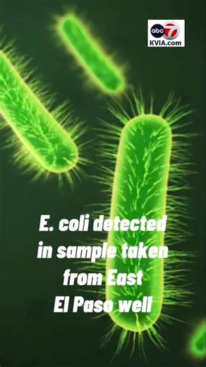 El Paso Water detected E. coli in a raw groundwater sample taken from a well in East El Paso today. The well water had not yet entered the disinfection process or the water distribution system, El Paso Water says. The well is located at 95 Walter Jones Boulevard, near the Butterfield Trail Golf Club. The well is one of 157 throughout the city. All undergo regular testing and monitoring to assure water quality, according to an El Paso Water spokesperson. #elpaso #texas | KVIA ABC-7