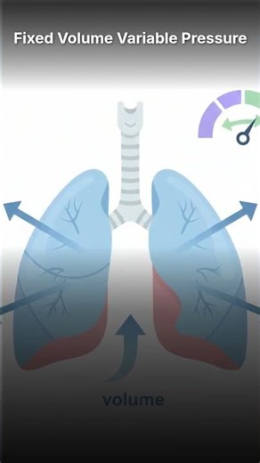 what is volume control ventilation? #criticalcare #icu #nclex #ventilator #nurses #nursing