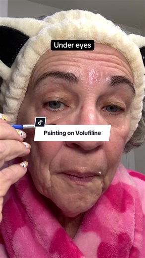 Targeted Volufiline Application for Mature Skin Over 50