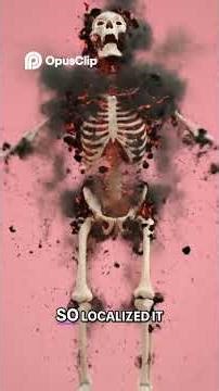 Spontaneous Human Combustion Burning From The Inside Out!