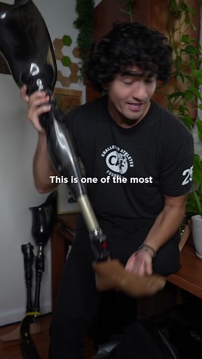 The Fight for the Most Advanced Prosthetic Leg | Alex1leg Story