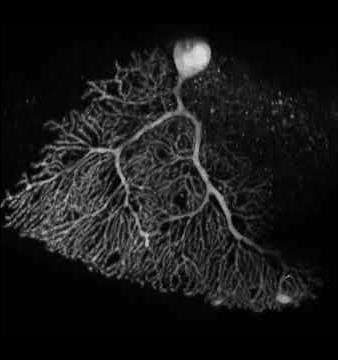 Cerebellar purkinje neuron
