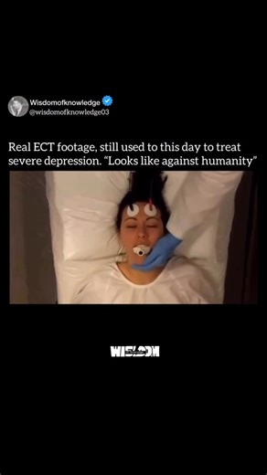 𝐖𝐢𝐬𝐝𝐨𝐦 𝐨𝐟 𝐤𝐧𝐨𝐰𝐥𝐞𝐝𝐠𝐞 on Instagram: "First introduced in the 1930s, ECT has a long and complex history. Early forms of the treatment were often administered without anesthesia or proper regulation, leading to widespread fear and stigma. However, modern ECT is far safer and more precise, guided by strict medical standards and continuous monitoring. Today, ECT is primarily used to treat severe depression, bipolar disorder, and certain cases of schizophrenia-especially when other the