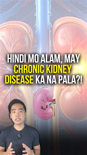 Hindi mo namamalayan, may kidney disease ka na pala?! Bakit ba napakahirap ma-diagnose ang CKD? #kidneydisease #kidneyfailure #fblifestyle | Dr. Carlo Trinidad - Kidney MD