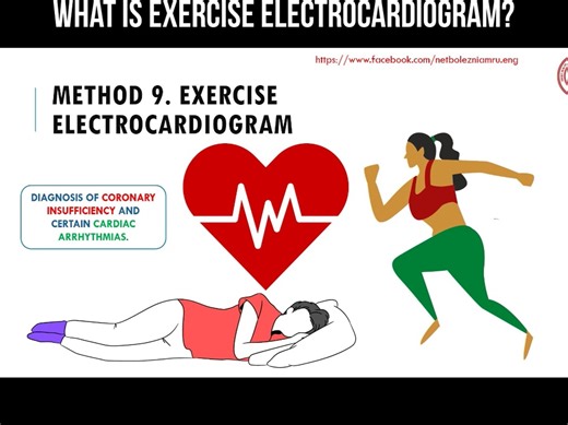 What is exercise electrocardiogram?